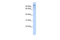 ZNF509 Rabbit anti-Human, Polyclonal, Novus Biologicals 0.1ml; Unconjugated:Antibodies,